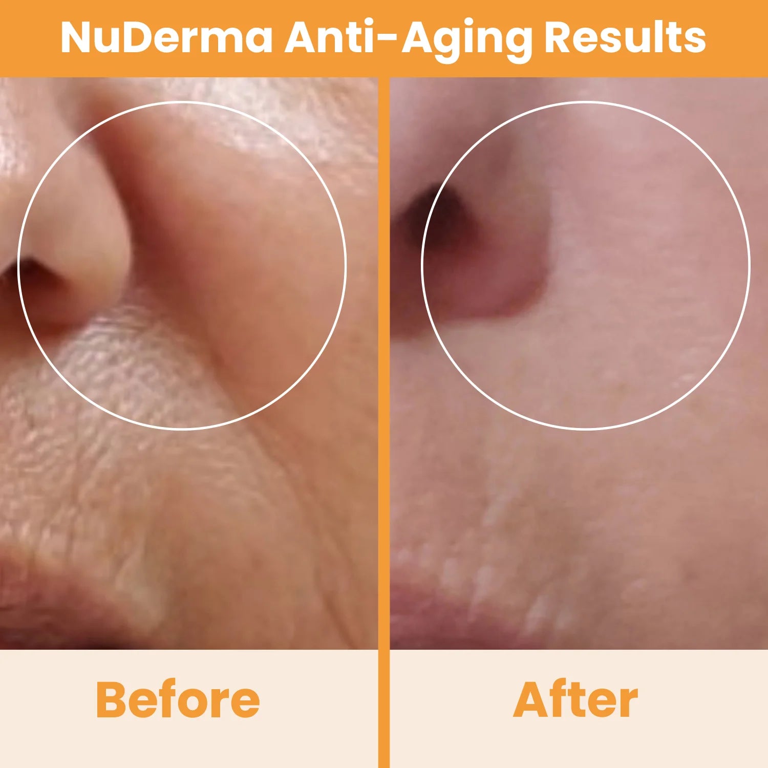 Nuderma Standard High Frequency Wand